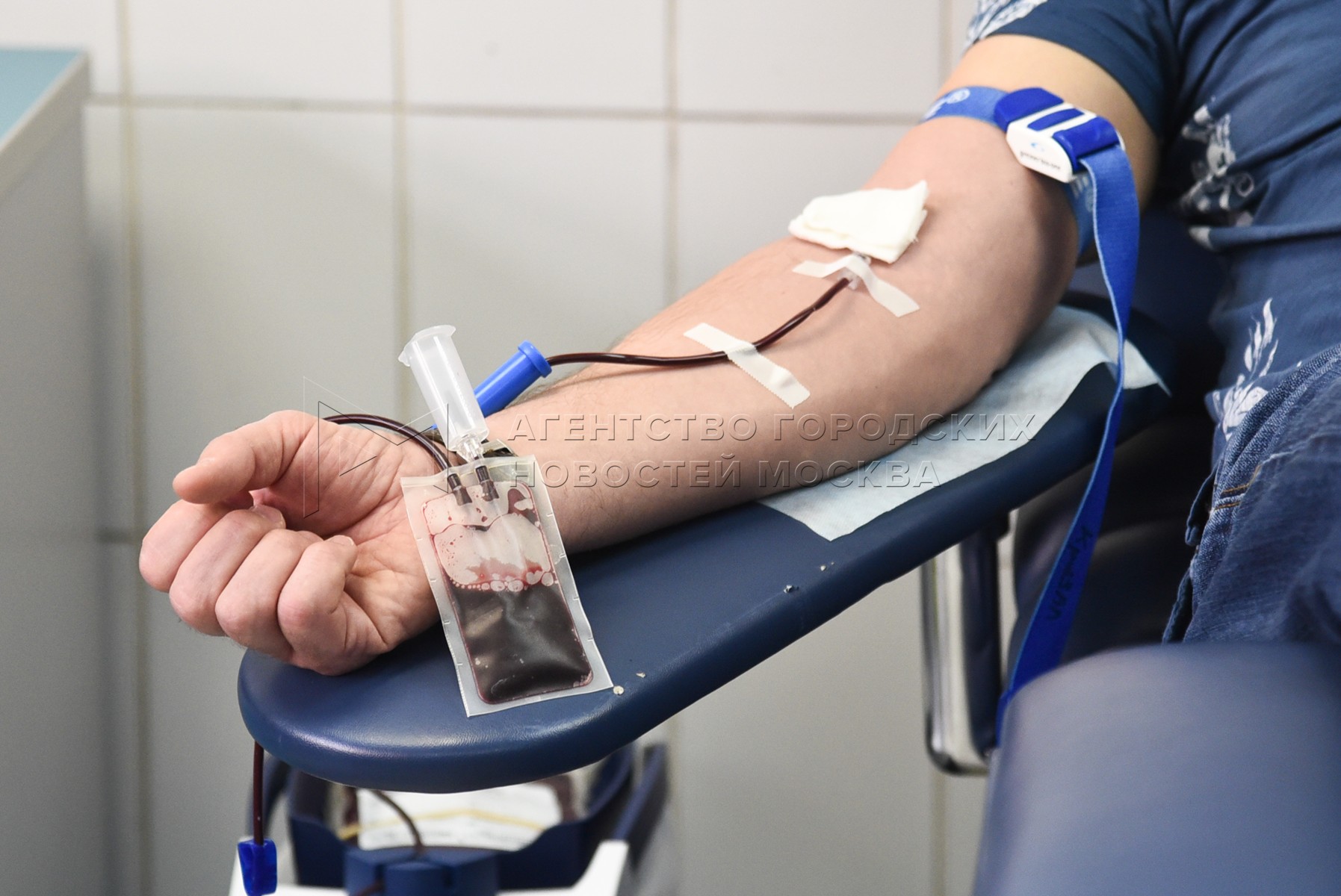 Донорство фмба. Прямое переливание крови. Прямое переливание донорской крови.